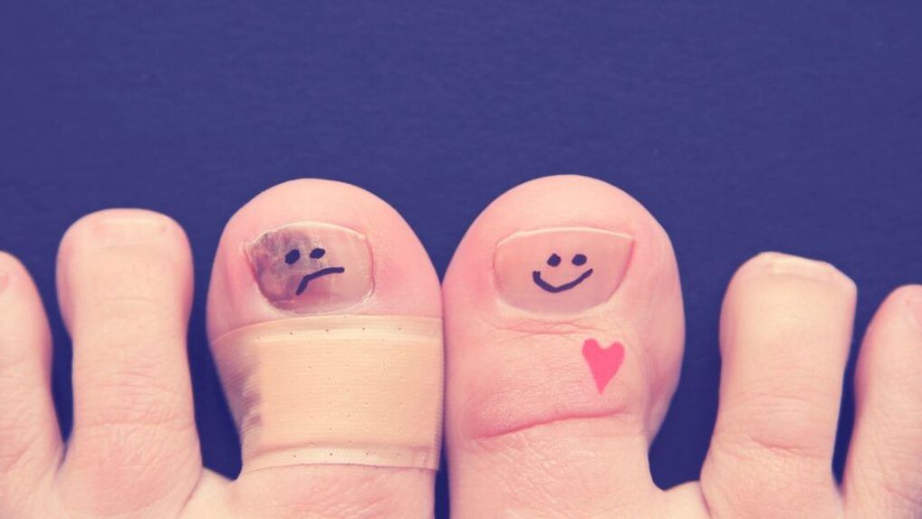Why is onychomycosis dangerous