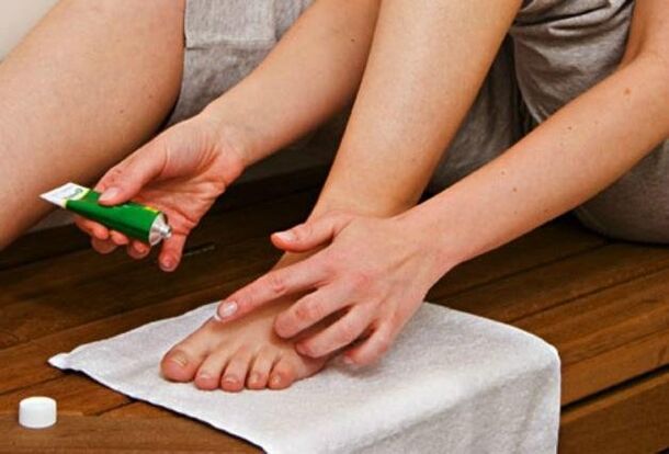 Apply antifungal ointment to feet to treat fungal diseases