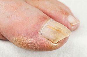 Ground - Finger