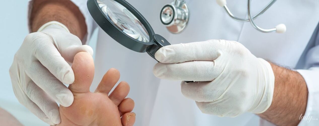 Doctor checks fungi on toes