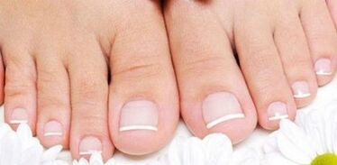 Prevent the appearance of fungi on the nails on the legs