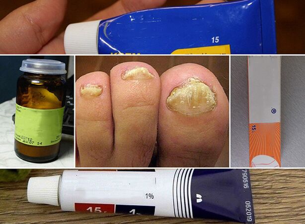 General principles of fungal therapy