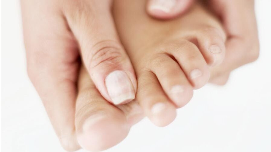 Itching of the big toe caused by onychomycosis