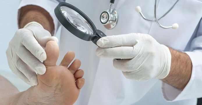 The doctor checks for nail fungus on the feet