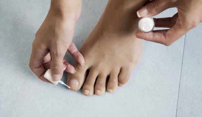 Treat the fungus on the big toe with varnish