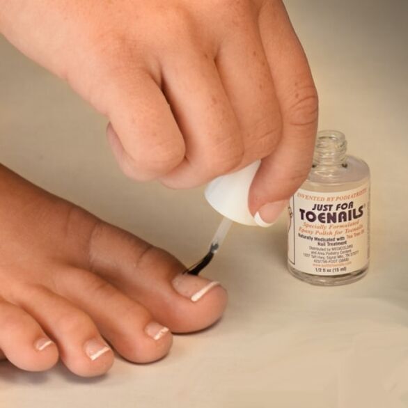 Fungal varnish is used in the early stages of nail fungal infection